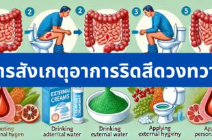 วิธีรักษาริดสีดวง ด้วยตัวเอง
